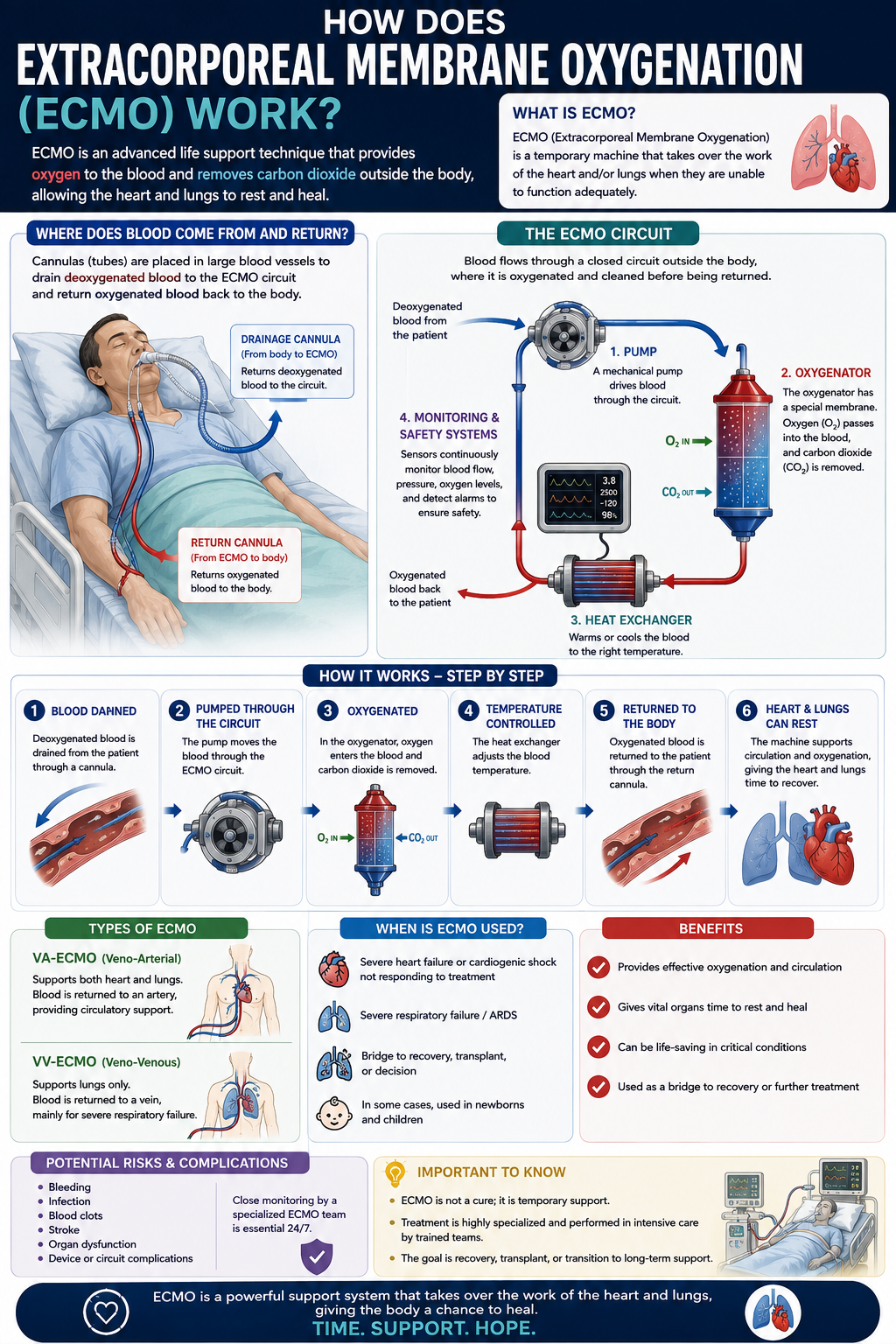 ecmo